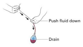 stripping the drain post mastectomy wound care page Dr. Miltenburg