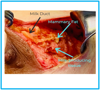 Close up of the inside of a breast